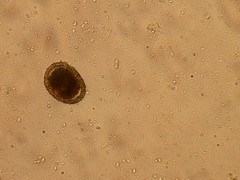 Imagen de microscopio ANALISIS DE HECES DE UN CACHORRO. TOXOCARA, parásito intestinal